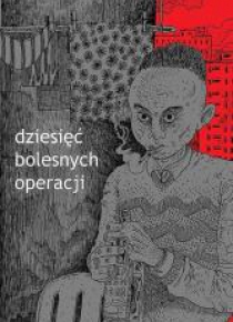 Dziesięć bolesnych operacji