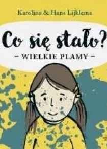 Co się stało? Wielkie plamy