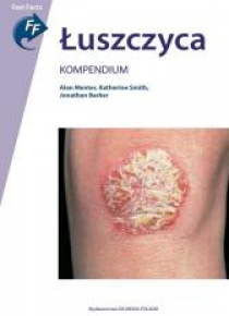 Łuszczyca. Kompendium