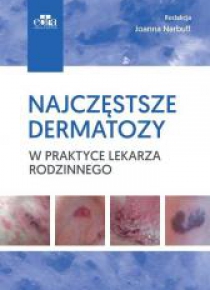 Najczęstsze dermatozy w praktyce lekarza rodzinn.