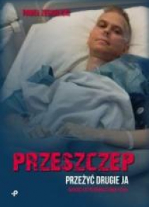 Przeszczep