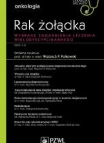 Rak żołądka